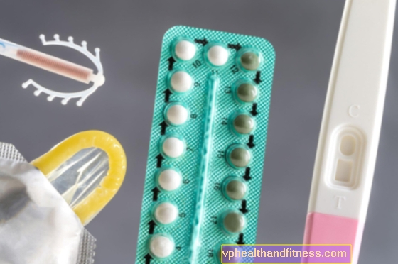 Anticoncepción para adolescentes: métodos anticonceptivos para adolescentes